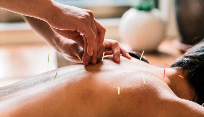 The Evolution of Acupuncture: From Ancient China to Worldwide Recognition
